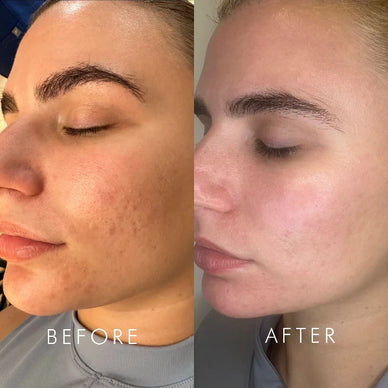 Reveal Your Skin's Natural Glow