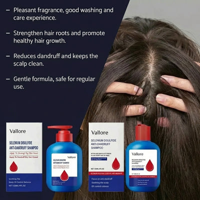 Selenium Sulfide Shampoo — Deep Cleansing Scalp Treatment