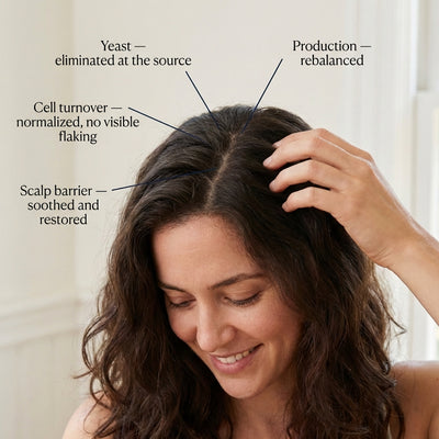 Selenium Sulfide Shampoo — Deep Cleansing Scalp Treatment