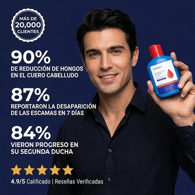 Selenium Sulfide Shampoo — Tratamiento de Limpieza Profunda del Cuero Cabelludo