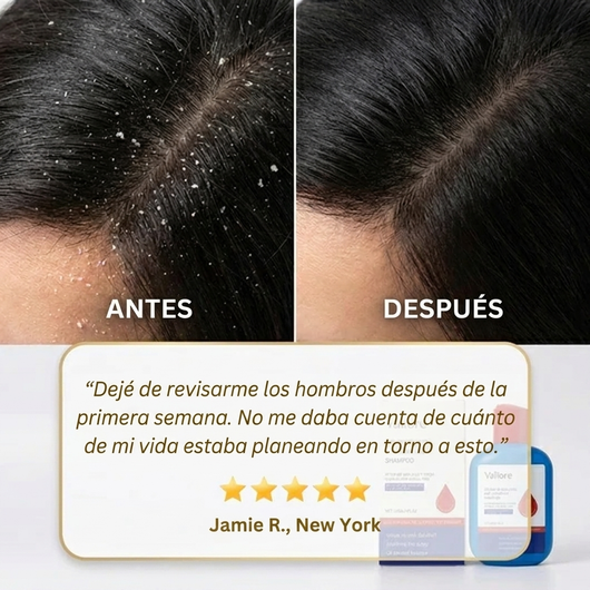 Selenium Sulfide Shampoo — Tratamiento de Limpieza Profunda del Cuero Cabelludo